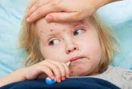 دردناک‌ترین علائم بیماری کاوازاکی در کودکان