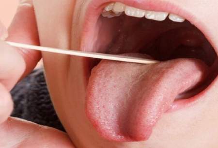 چرا دچار خشکی دهان می‌شویم؟