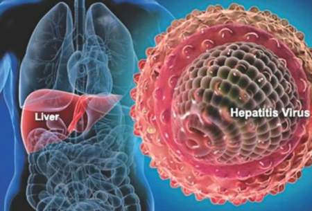 هپاتیت منجر به ناباروری درمردان و زنان می‌شود