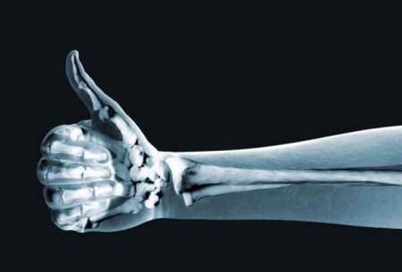 تصویربرداری اشعه ایکس با ابزار پوشیدنی
