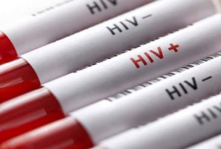 درمان آزمایشی HIV وارد تست انسانی شد