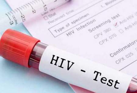 سرکوب HIV با یک روش جدید