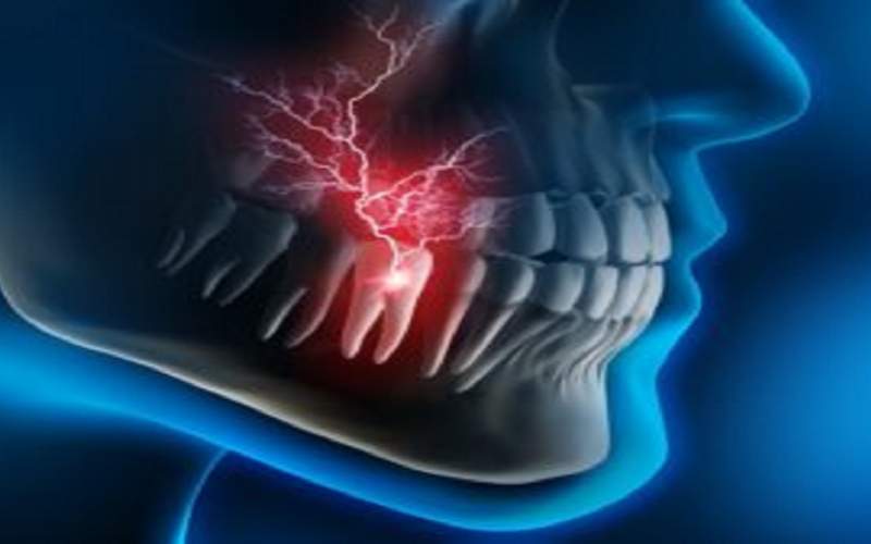 ۹ روش برای رهایی از شر دندان درد