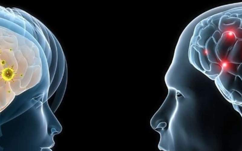استفاده بیشتر «زنان» از دو نیمکره مغز