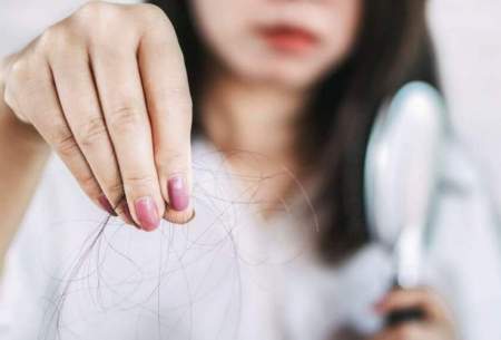 راهکارهایی که از ریزش موی جلوگیری می‌کند