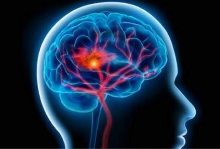 شیوع یک بیماری "مرموز" مغزی در کانادا