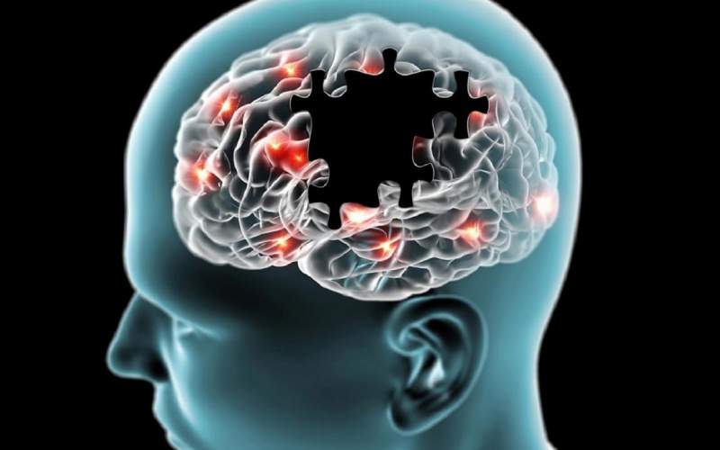 شناسایی و کشف علت پیشرفت آلزایمر در مغز