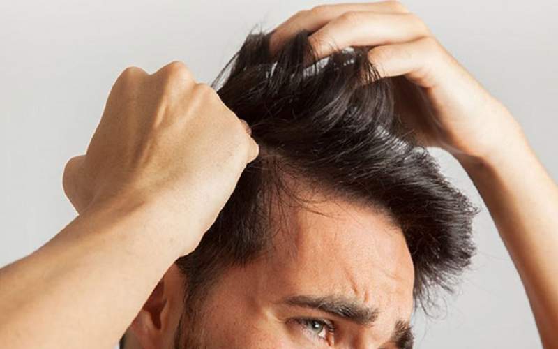 چه عواملی بر ریزش مو تاثیرگذار است؟
