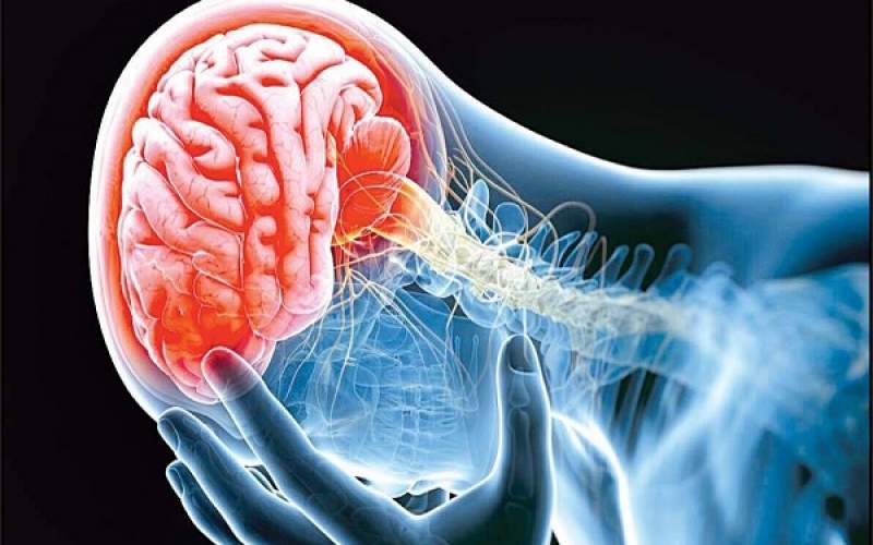 محرومیت از درمان‌ علت اصلی سکته مغزی