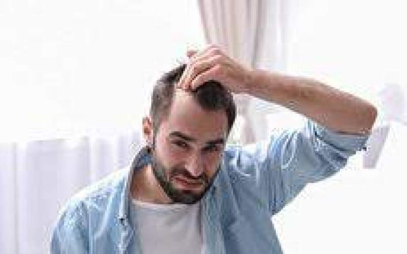 ۷ خوراکی موثر در پیشگیری از ریزش مو‌ها