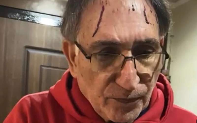 در ویدئویی که از محمد نوری‌زاد منتشر شد، زخم‌هایی روی سر او دیده می‌شود