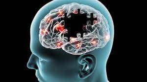اختلالات مغزی ناشی از جهش ژنی آلزایمر