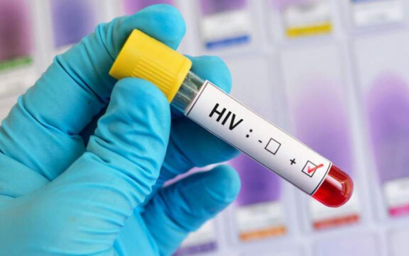 درمان موفق HIV در آستانه آزمایشات انسانی