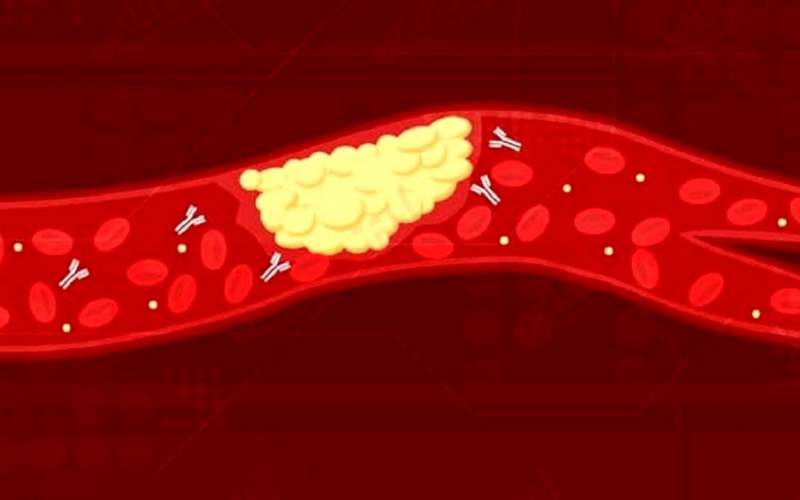 کشف دلیل بروز ترومبوز در بیماران کرونایی