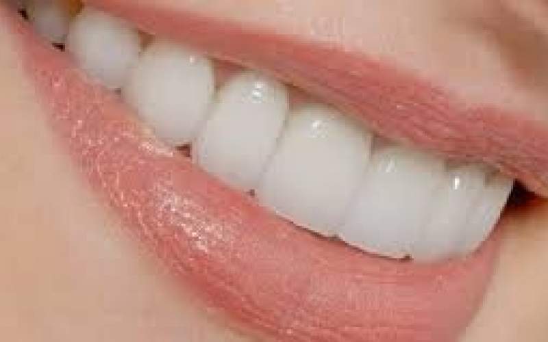 چگونه می‌توان از دندان‌ها مراقبت کرد؟