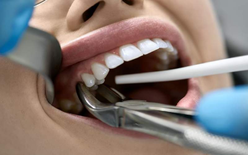 5 زمانی که حتما نیاز به کشیدن دندان دارید