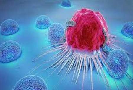 روشی نوین برای تشخیص سریع تومور سرطانی