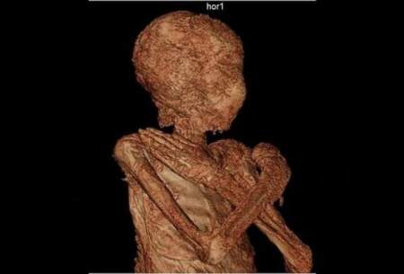 حفظ جنین در بدن زن مومیایی ۲ هزار ساله