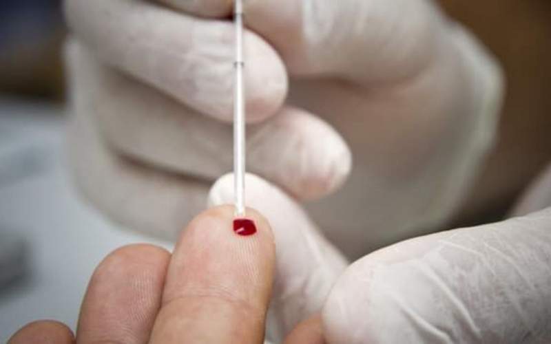 کشف گونه جدید و خطرناک ویروس ایدز در هلند