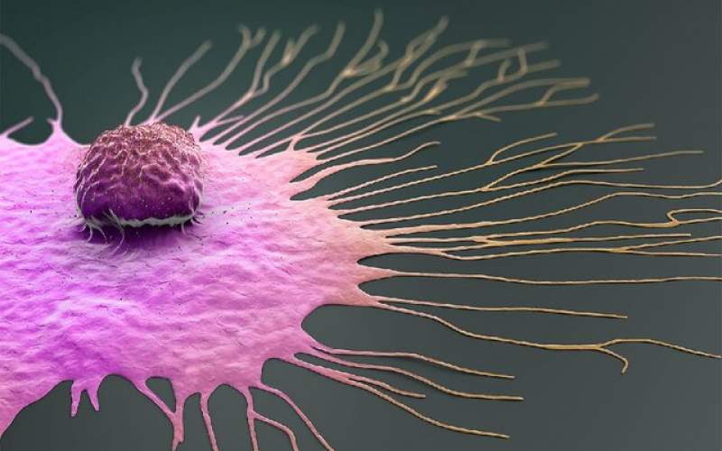 سرطان سینه چگونه در بدن پیشروی می‌کند؟