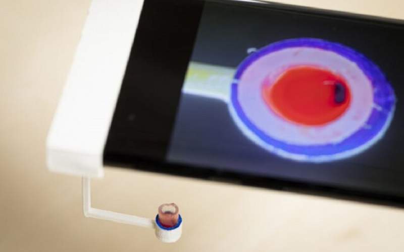 بررسی لخته شدن خون با تلفن همراه!
