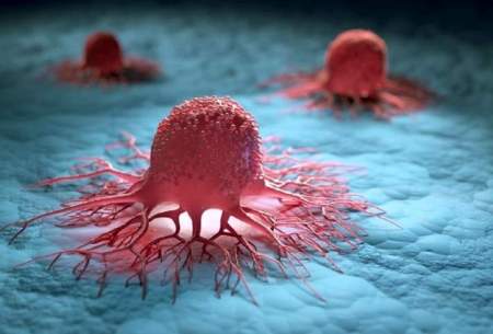 سرطان سینه چگونه در بدن پیشروی می‌کند؟
