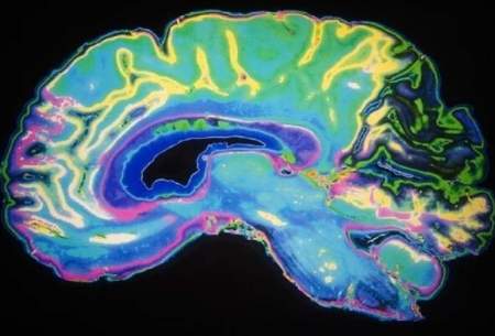 کشف نورون‌های مسئول "ریاضیات" در مغز