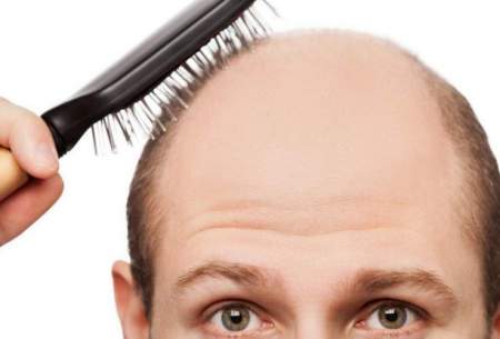 معجزه مصرف آب این سیفی برای درمان ریزش مو