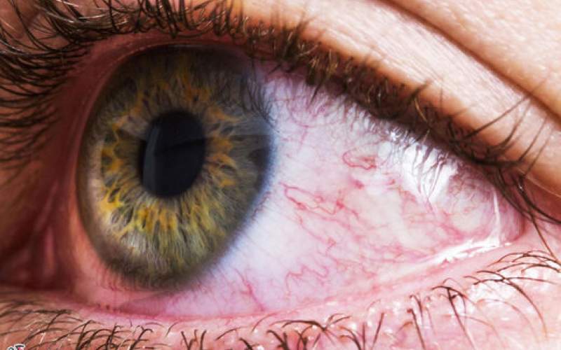 سلامت چشم چه ارتباطی با دستگاه گوارش دارد؟