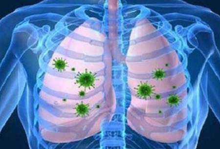 پاکسازی ریه‌ها با این سه روش طبیعی