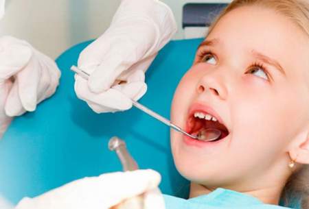 دندانی که عصب کشی شده چقدر دوام می آورد؟