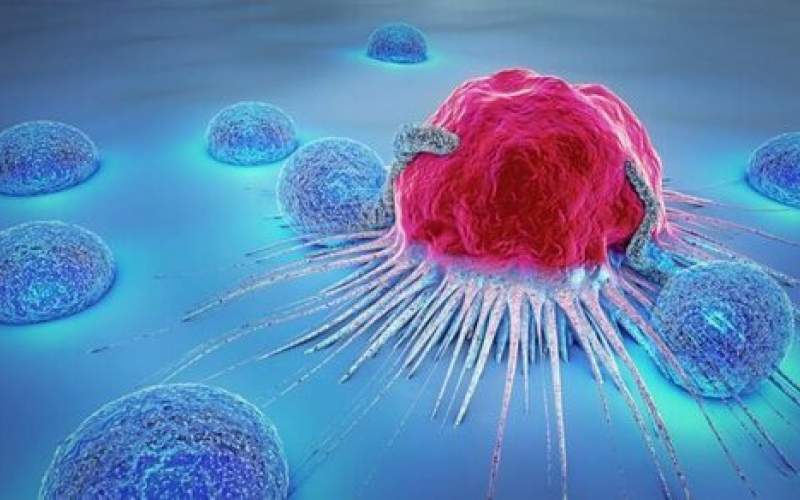 راه‌های پیشگیری از سرطان شایع زنان چیست؟