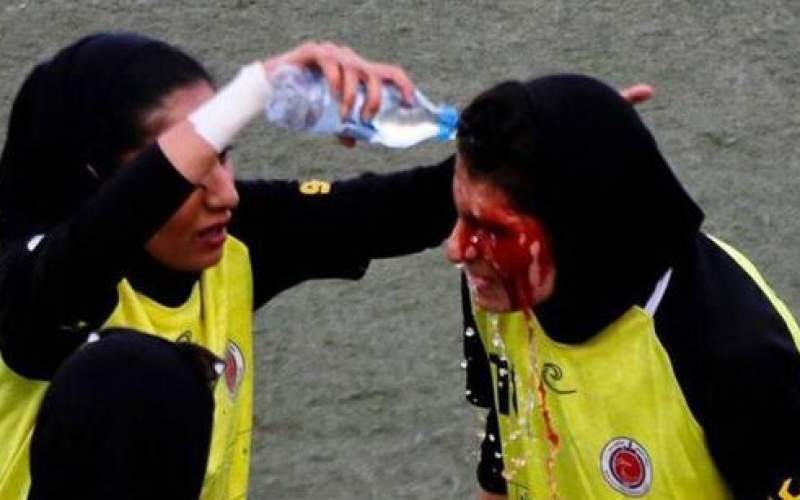 تصویری وحشتناک از فوتبال زنان ایران