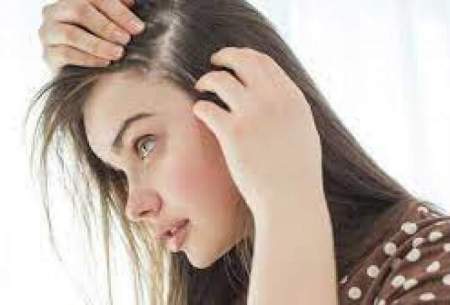قرص ضد کرونا برای درمان ریزش مو مؤثر است