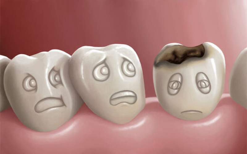 عادت نادرستی که دندان‌هایتان را خراب می‌کند