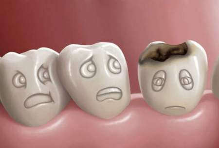 عادت نادرستی که دندان‌هایتان را خراب می‌کند