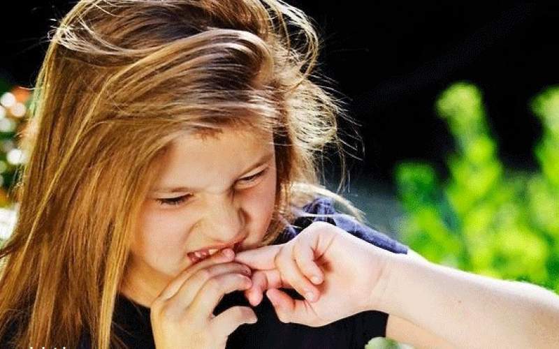 ۶ راهکار ساده برای جلوگیری از جویدن ناخن