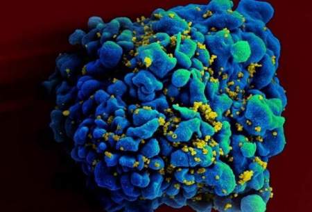 ویروس HIV فرایند پیری بدن را تسریع می کند