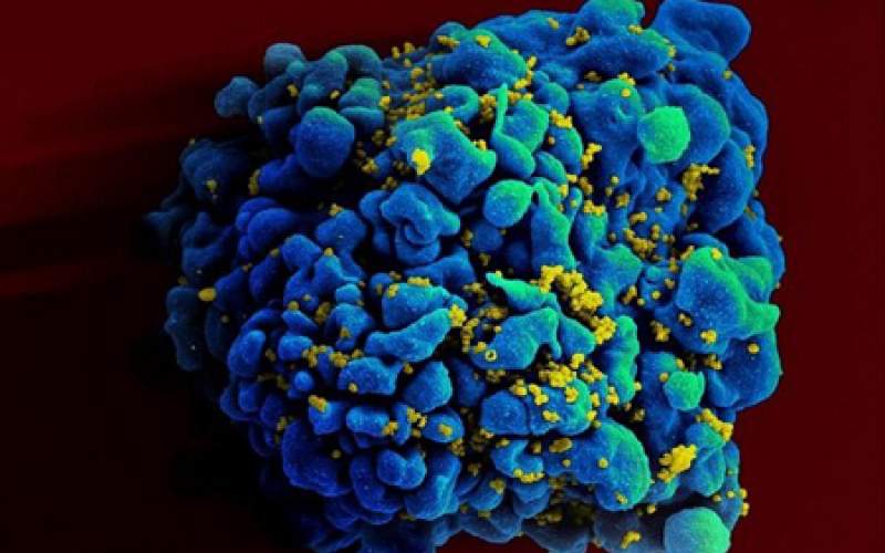 ویروس HIV فرایند پیری بدن را تسریع می کند