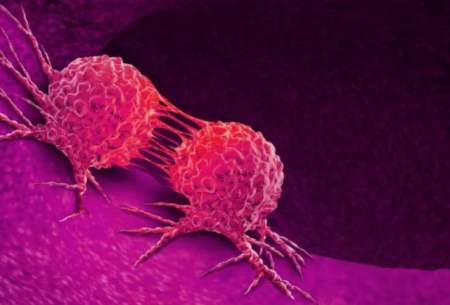 روشی‌نوین برای ازبین بردن‌سلول‌های‌سرطانی