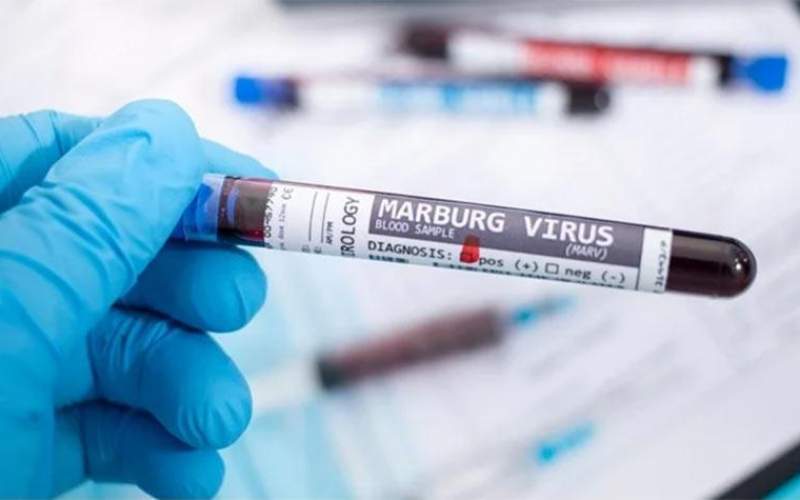 ویروس ماربورگ چه علائمی ایجاد می‌کند؟