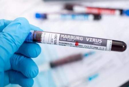 ویروس ماربورگ چه علائمی ایجاد می‌کند؟