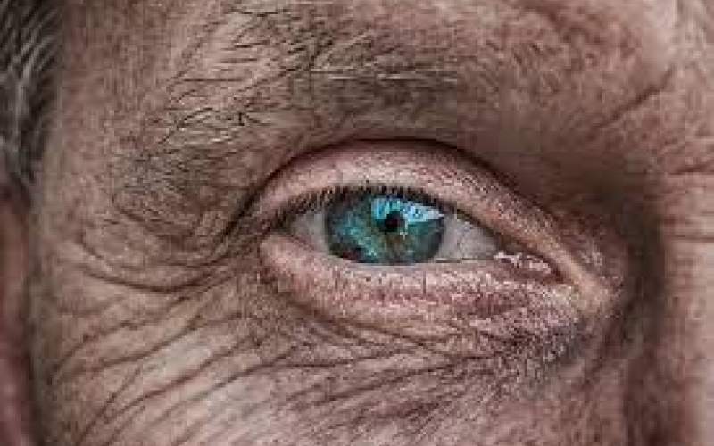 پیش‌بینی احتمال ابتلا به آلزایمر با بررسی تغییرات شبکیه