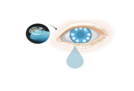 تشخیص سرطان به وسیله لنز هوشمند از روی اشک چشم