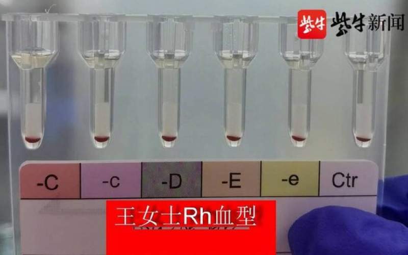 شناسایی ۲ زن با "خون طلایی" در شرق چین