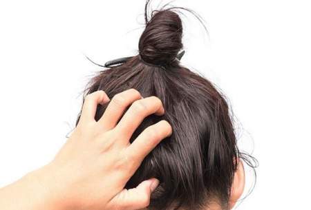 ماده‌ای موثر در درمان ریزش مو را بشناسید