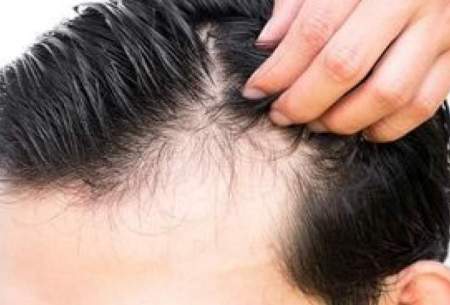 تاثیر استرس در بروز بیماری‌های پوست و مو