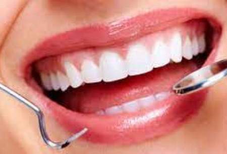 تاثیر رژیم غذایی در ایجاد پوسیدگی دندانها