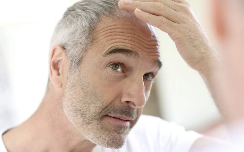 راه های جلوگیری از سفید شدن مو را بشناسید