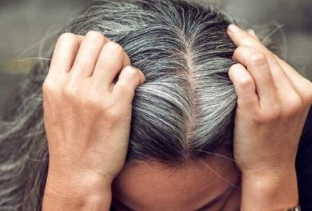 آیا استرس یکی از عوامل سفید شدن مو است؟